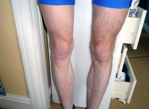 shave-legs